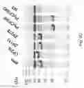 Fig. 14 - METHOD FOR REDUCING CONTAMINATION OF AN OBJECT WITH CLOSTRIDIUM