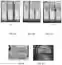 Fig. 04 - Technology for water dispersible phospholipids and lysophospholipids