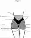 Fig. 02 - Convex Padded Hip Enhancing Garment