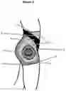 Fig. 04 - Convex Padded Hip Enhancing Garment