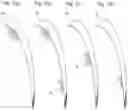 Fig. 08 - WIG AND PROCESS FOR PREPARING A WIG