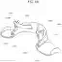Fig. 10 - Head and Neck Restraining System With An Adjustable Tether and Pressure Distributing Contouring