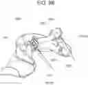 Fig. 11 - Head and Neck Restraining System With An Adjustable Tether and Pressure Distributing Contouring