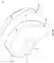 Fig. 09 - Helmet with flexible structure for improved force attenuation