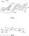 Fig. 09 - Molded footwear upper and method of making same