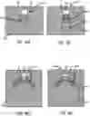 Fig. 16 - Tension member guides for lacing systems