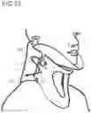 Fig. 63 - Closing device having a winding element