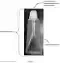 Fig. 03 - Liquid Applicator and Device