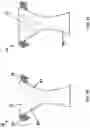 Fig. 16 - Diaper Changing System and Method