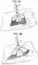 Fig. 06 - BROOM WITH INTEGRATED SUCTION DEVICE