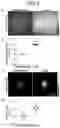 Fig. 05 - Miniature image relay endoscopy probe and multi-photon endoscopy including the same