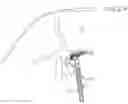 Fig. 04 - MATHIS LAPAROSCOPIC INGUINAL HERNIA ILLUMINATOR