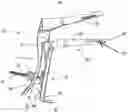 Fig. 01 - Vaginal speculum