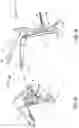 Fig. 05 - Vaginal speculum