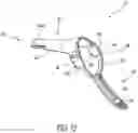 Fig. 12 - Vaginal speculum