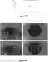 Fig. 03 - Devices and methods for measurement and correction of high-order optical aberrations for an eye wearing a contact lens