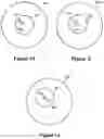Fig. 05 - Devices and methods for measurement and correction of high-order optical aberrations for an eye wearing a contact lens