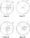 Fig. 07 - Devices and methods for measurement and correction of high-order optical aberrations for an eye wearing a contact lens