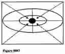 Fig. 04 - I-Examination