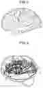Fig. 03 - Magnetic resonance imaging apparatus and image processing apparatus
