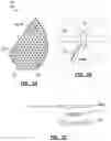 Fig. 04 - TEMPERATURE-BASED DENSITY-AGNOSTIC SYSTEM AND METHOD FOR BREAST CANCER DIAGNOSIS