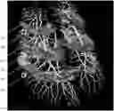 Fig. 01 - Method of scanning and assessing lung and vascular health