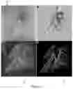 Fig. 04 - Method of scanning and assessing lung and vascular health