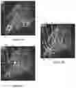 Fig. 05 - Method of scanning and assessing lung and vascular health