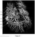 Fig. 08 - Method of scanning and assessing lung and vascular health