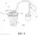 Fig. 13 - Method of estimating blood volume