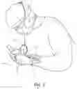 Fig. 07 - SYSTEMS AND METHODS FOR INTRA-OPERATIVE STIMULATION