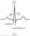 Fig. 04 - Selection of optimal channel for rate determination