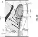 Fig. 04 - Shoe-based analysis system