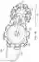 Fig. 03 - METHOD FOR CATHETER-BASED CLUTCHED HEART VALVE SIZER