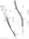 Fig. 22 - METHOD FOR CATHETER-BASED CLUTCHED HEART VALVE SIZER