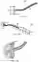 Fig. 24 - METHOD FOR CATHETER-BASED CLUTCHED HEART VALVE SIZER