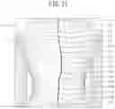 Fig. 11 - Spinal-column arrangement estimation-apparatus, spinal-column arrangement estimation method, and spinal-column arrangement estimation program