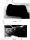 Fig. 02 - METHOD OF FORMING A THREE-DIMENSIONAL CONDUCTIVE KNIT PATCH
