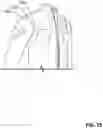 Fig. 25 - GARMENT WITH SAFETY FEATURES
