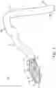 Fig. 04 - Intravascular device movement speed guidance and associated devices, systems, and methods