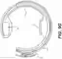Fig. 13 - Portable medical imaging system