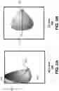Fig. 03 - Techniques for patient positioning quality assurance prior to mammographic image acquisition