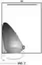 Fig. 08 - Techniques for patient positioning quality assurance prior to mammographic image acquisition