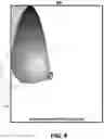 Fig. 09 - Techniques for patient positioning quality assurance prior to mammographic image acquisition