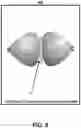 Fig. 10 - Techniques for patient positioning quality assurance prior to mammographic image acquisition