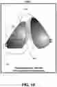 Fig. 11 - Techniques for patient positioning quality assurance prior to mammographic image acquisition