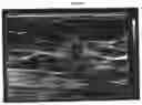 Fig. 06 - Methods and systems to determine cancer molecular subtypes based on ultrasound and/or optoacoustic (OA/US) features