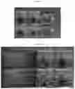 Fig. 12 - Methods and systems to determine cancer molecular subtypes based on ultrasound and/or optoacoustic (OA/US) features