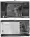 Fig. 22 - Methods and systems to determine cancer molecular subtypes based on ultrasound and/or optoacoustic (OA/US) features