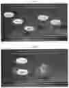 Fig. 29 - Methods and systems to determine cancer molecular subtypes based on ultrasound and/or optoacoustic (OA/US) features